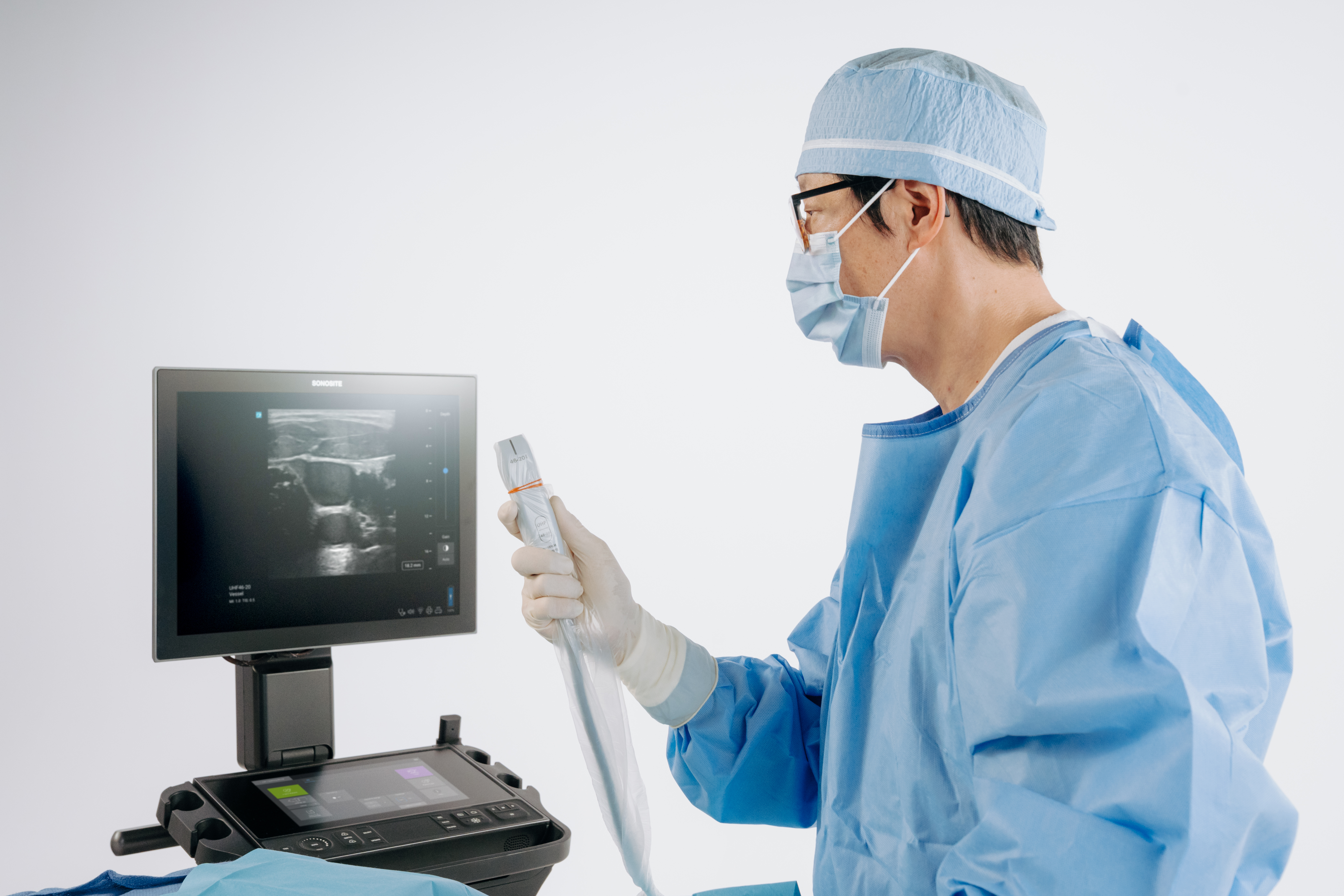 What is Ultra High Frequency Ultrasound? | FUJIFILM Sonosite